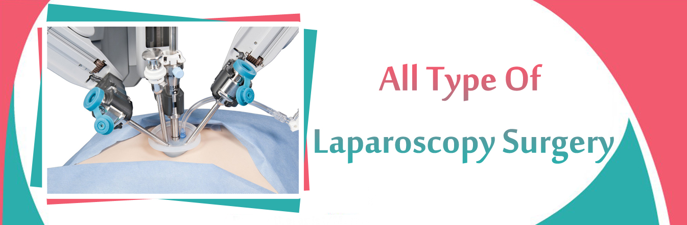 Best laparoscopic Surgeon in kota
