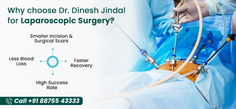 Lap Appendix Appendix Removal by Laparoscopy Surgery in Kota - Jindal Endo ...