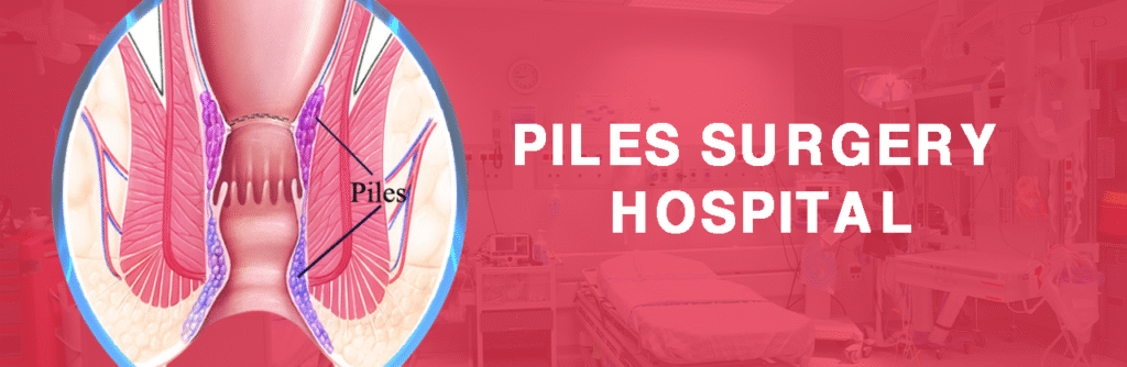 Piles Treatment in Kota