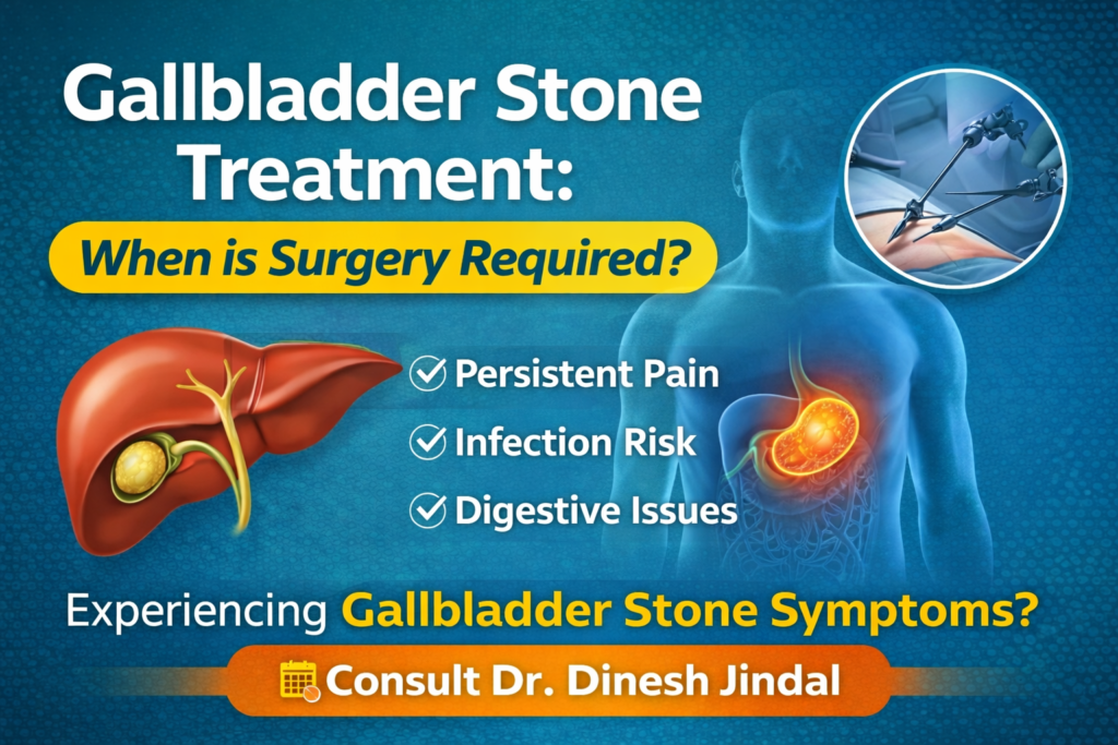 Gallbladder Stone Treatment: When is Surgery Required?